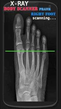 X-ray cloth Scanner Prank screenshot 2