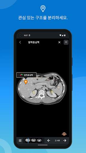 e-Anatomy screenshot 4