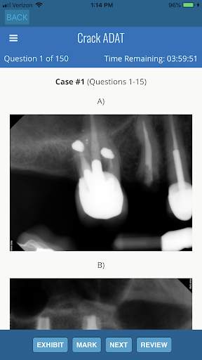 ADAT Exam Preparation screenshot 3