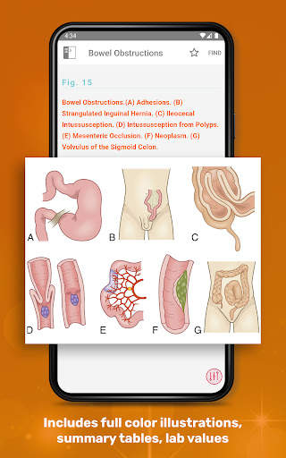 Medical Surgical RN Companion screenshot 15