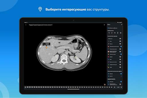 e-Anatomy скриншот 12