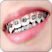 Real Braces Teeth Booth Pro icon