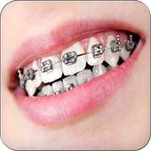 Real Braces Teeth Booth Pro 2.0