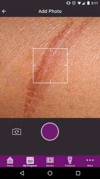 My Mederma screenshot 1