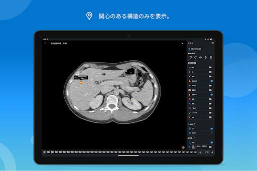 e-Anatomy screenshot 12