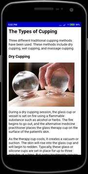 Cupping Therapy screenshot 3