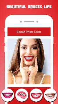 Braces Photo Editor 2018 screenshot 7