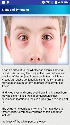 Help for Baby Conjunctivitis & Pinkeye in Children screenshot 2