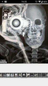 Super Funny X-Ray screenshot 2