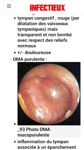 Maladie Infectieuse screenshot 13
