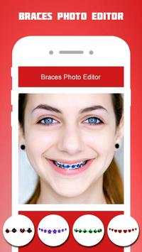 Braces Photo Editor 2018 screenshot 1