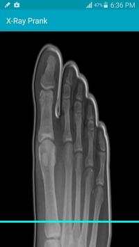 X Ray Scanner Prank screenshot 4