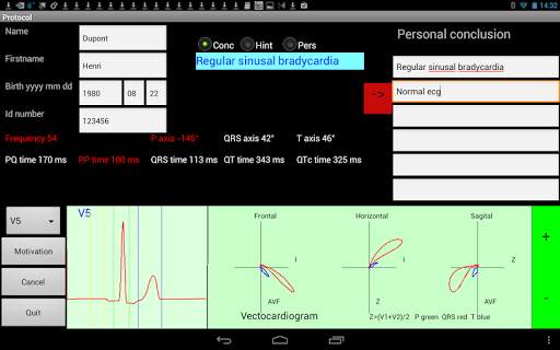 Mobile ecg recording screenshot 7