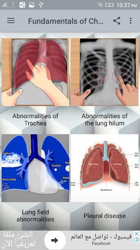 Chest X-Ray Interpretation screenshot 2