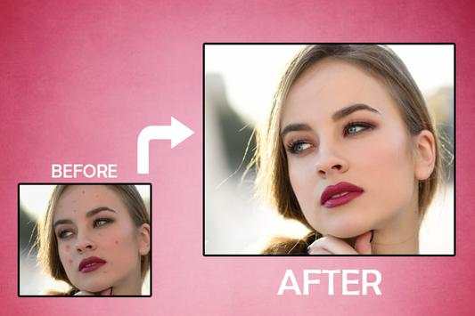 Pimple Remover-Pimple Eraser screenshot 5