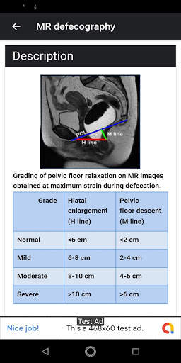 Radiology Measurements on finger tips screenshot 3