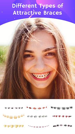 Teeth Braces Photo editor screenshot 2