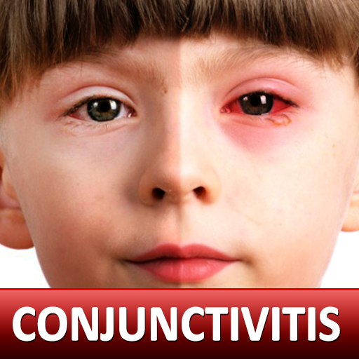 Help for Baby Conjunctivitis &amp; Pinkeye in Children icon