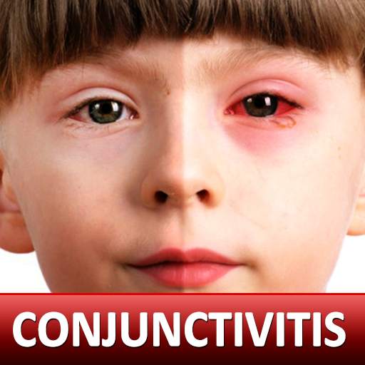 Help for Baby Conjunctivitis & Pinkeye in Children 1.9