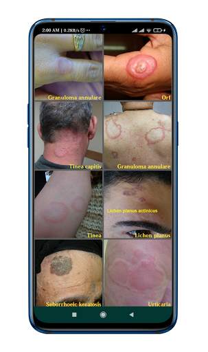 DrugRx (disease,diagnosis) screenshot 8