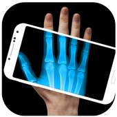 Xray Scanner 1.1