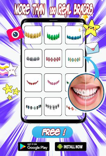 Braces Teeth  Photo Editor screenshot 1