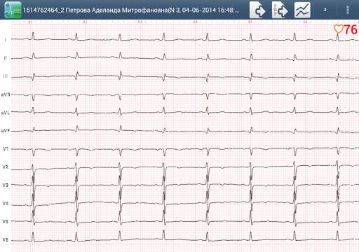 Easy ECG Mobile PRO screenshot 8