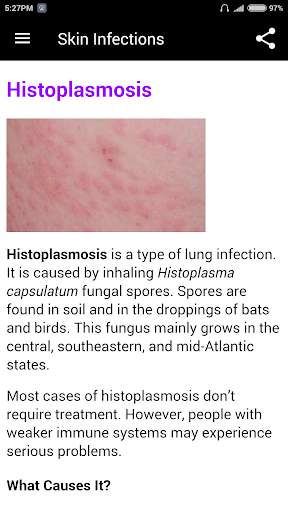 Skin Infections screenshot 5