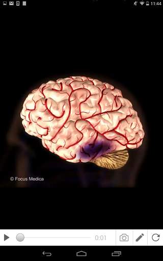 Stroke screenshot 6
