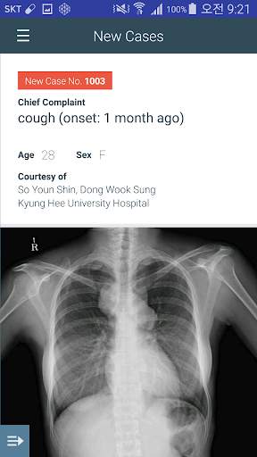 KSTR Weekly Chest Cases screenshot 3