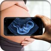 Ultrasound Scanner (Prank)