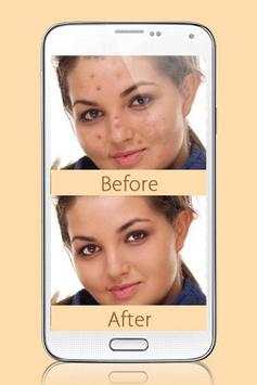 Photo Editor Blemish screenshot 2