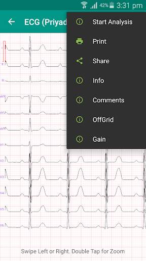 eUNO-WiFi screenshot 7
