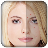 Pimple Remover-Pimple Eraser icon