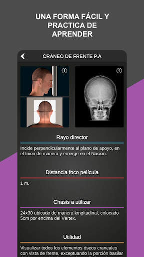 RX - Posiciones Radiológicas screenshot 3