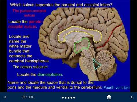 Neuroanatomy Lite - SecondLook screenshot 2