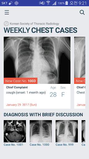 KSTR Weekly Chest Cases screenshot 2