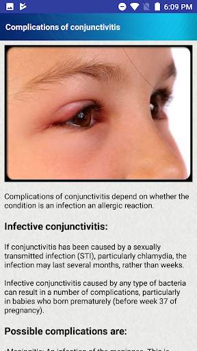 Help for Baby Conjunctivitis & Pinkeye in Children screenshot 5