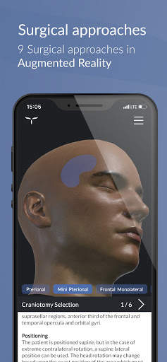 UpSurgeOn Neurosurgery screenshot 1