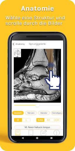 MRI Essentials screenshot 6