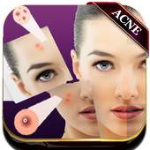 Acne Remover Photo Editor - Pimple remover 1.0