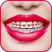 Braces Photo Editor 1.0
