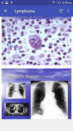 Hematology Overview screenshot 6