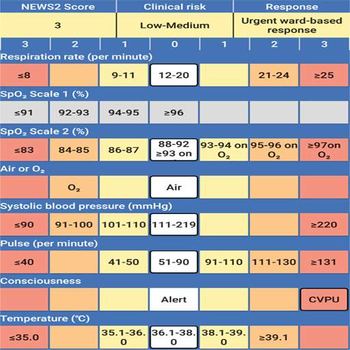 News 2 Chart Spanish 1.7