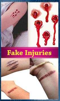 Injury Photo Maker-Fake Injury screenshot 1