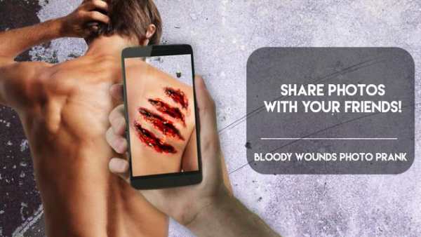 Bloody Wounds Photo PRANK screenshot 4