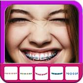 Beauty Brace Camera 1.0