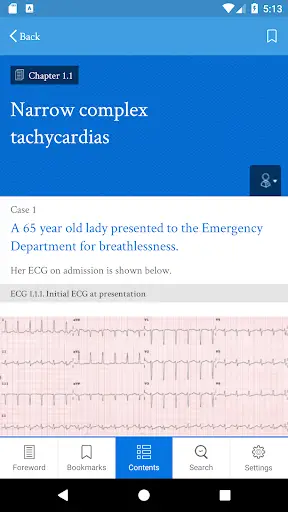 Dr ECG screenshot 4