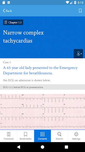 Dr ECG screenshot 4