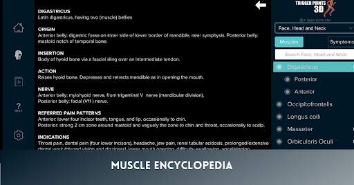 Trigger Points 3D screenshot 6